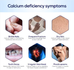 calcium-deficiency, कॅल्शियम कमी होण्याची लक्षणे व घरगुती उपाय
